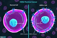 پاورپوینت اثر ژن HER2 و مسیر NF-KB درایجاد سرطان پستان (انگلیسی)